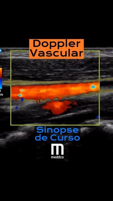 Curso Avançado de Doppler Vascular -Sinopse смотреть онлайн