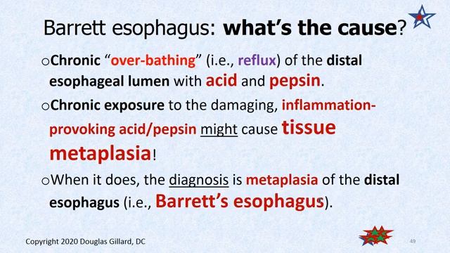 GI GU:(WK #3) (Thur)(Sum-2020): GERD, Barrett Esophagus, Esophageal Carcinoma, plus more... смотреть онлайн