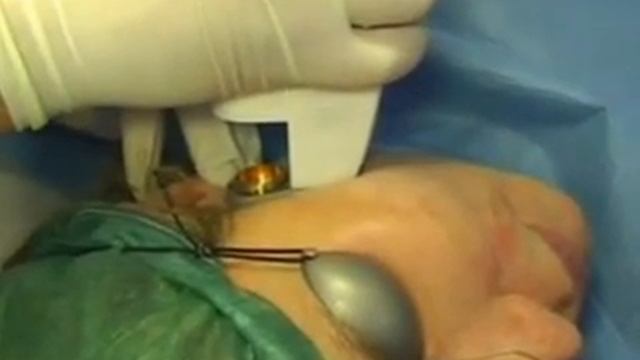 Quanta System - Skin Rejuvenation смотреть онлайн