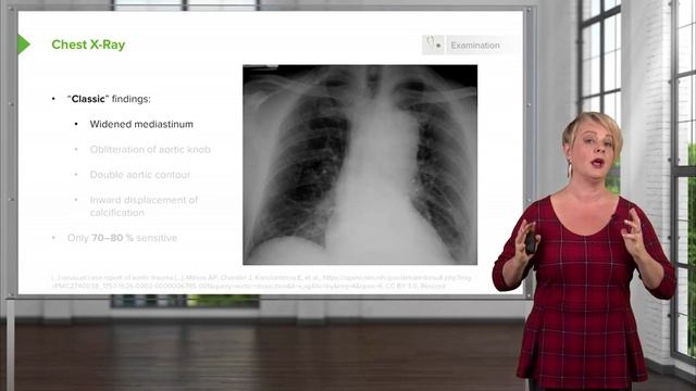 1.03 Aortic Dissection- History & Classic Findings смотреть онлайн