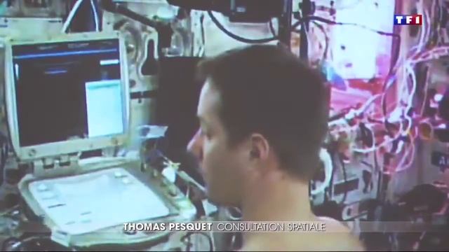 Французский космонавт Тома Пескэ использует УЗИ Sonoscanner на космической станции смотреть онлайн