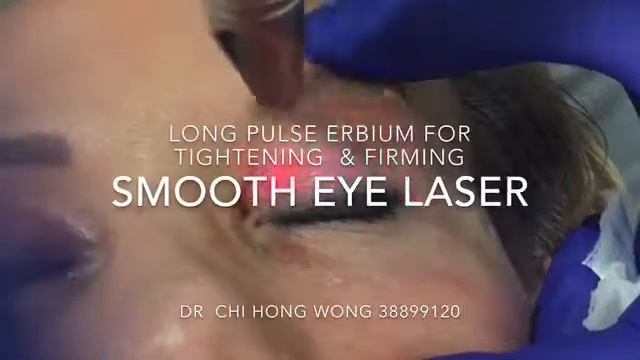 Fotona Smooth Eye Laser Brisbane - Laser to Tighten and Smooth Skin Around the Eyes смотреть онлайн