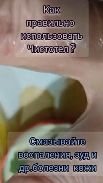 Как лечит мазь из чистотела? смотреть онлайн