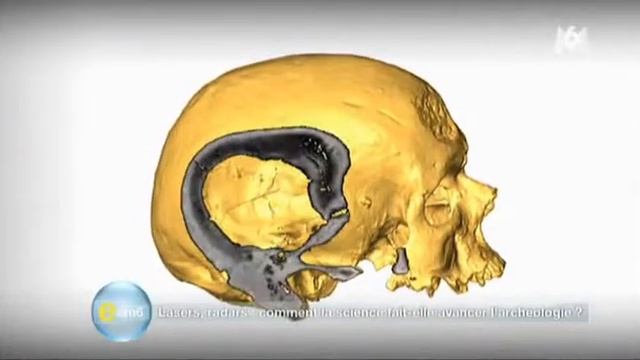 L'homme de Cro-Magnon passe au scanner смотреть онлайн