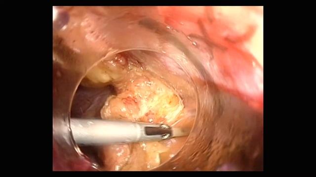 Adhesion 4 смотреть онлайн