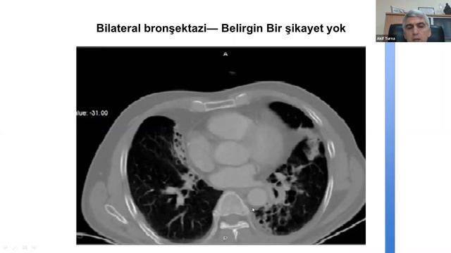 Kistik ve İnfektif Akciğer Hastalıkları смотреть онлайн