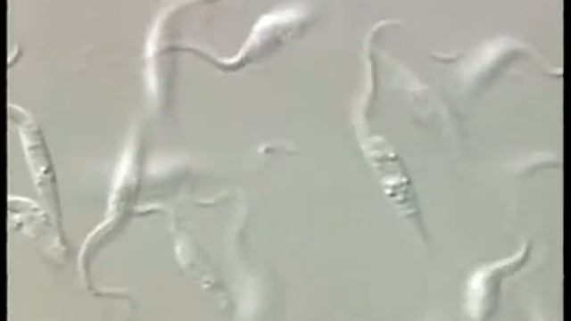 Trypanosoma смотреть онлайн