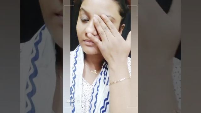 Some by me yuja Niacin brightening kit😱😱😱😱😱 смотреть онлайн