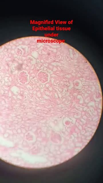 enlarged view of simple cuboidal epithelial tissue under microscope #mbbs#shorts #shortsmbbs #vira смотреть онлайн