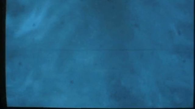 CO2 Laser TxAVI смотреть онлайн