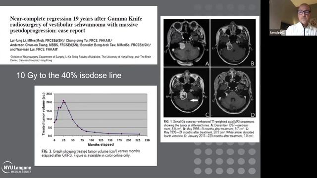Indications & Expectations after Gamma Knife Radiosurgery for Vestibular Schwannomas | House ONE смотреть онлайн