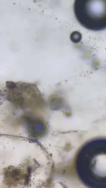 Microscope scanning virus #shorts #fyp #microscope #scanner #viral #science #technology #reels смотреть онлайн