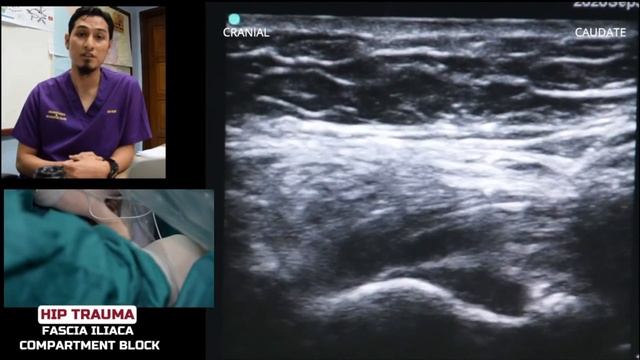 Part 3 : Lower Limb Regional Anaesthesia смотреть онлайн
