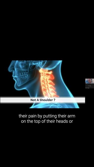 What clues will help you identify patients with neck driven shoulder pain? смотреть онлайн