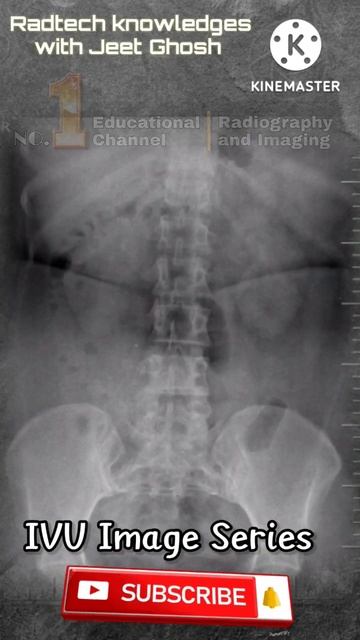 IVU | intravenous Urography #radiology #doctor #mbbsstudent смотреть онлайн