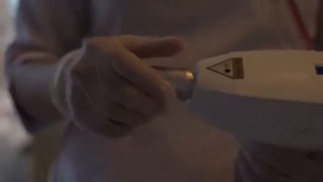 Nd:YAG Q-switch Super YAG - portativ Tatu silmə və Karbon pilinq aparatı смотреть онлайн