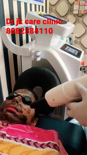 carbon laser facial |Hollywood facial смотреть онлайн
