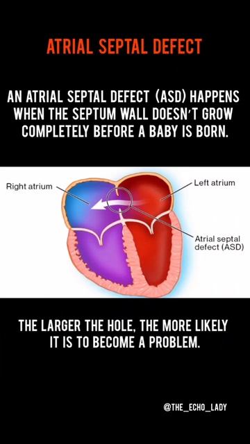 ASD or PFO? 👇🏻🫀🤔 #cardiology #healthcare #medical #echocardiogram смотреть онлайн