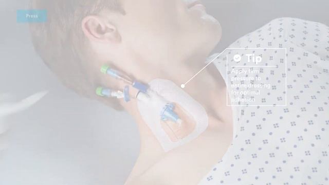 Tegaderm™ CHG (1657) Application & Removal For Multi-Lumen Introducers Video