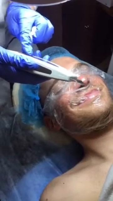 Ультразвуковая чистка лица в Киеве для мужчин и женщин, Оболонь смотреть онлайн