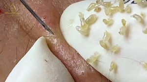 Relax New Day With Loan Nguyen Spa #012