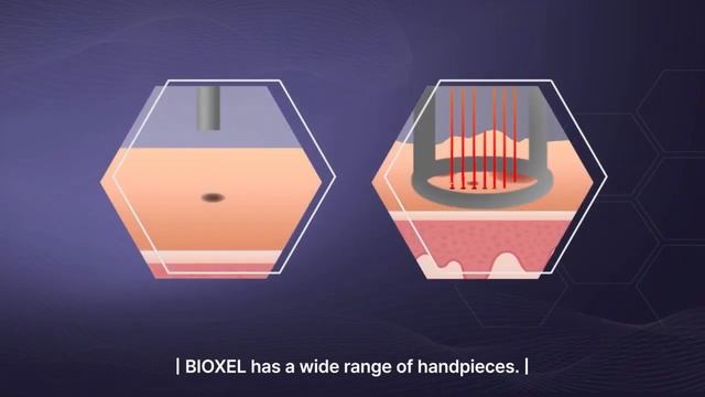 [AMI] BIOXEL│Fractional CO2 Laser смотреть онлайн