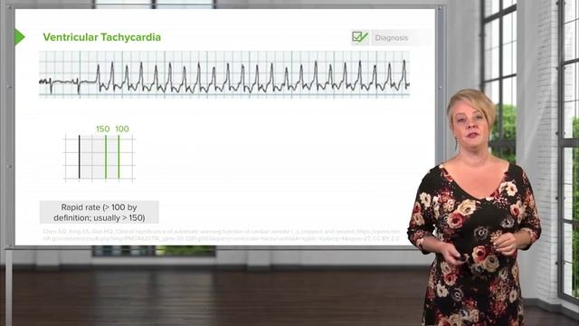 3.07 Ventricular Fibrillation_Tachycardia смотреть онлайн