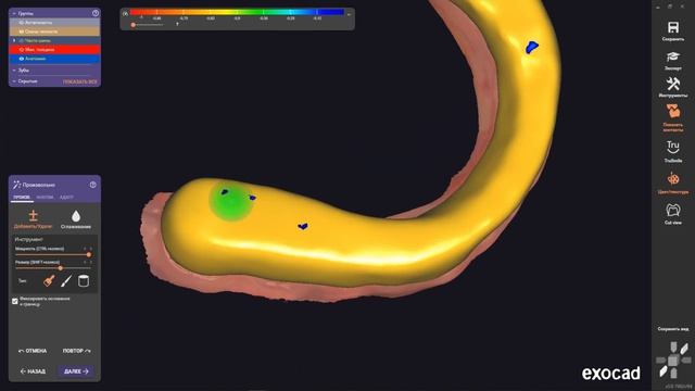 Exocad Byte Slint I Tooth Modeling 12