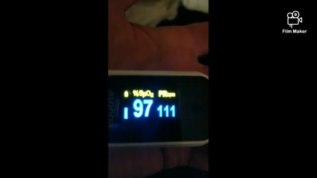 inappropriate sinus tachycardia multiple sclerosis related symptoms..2021.. смотреть онлайн