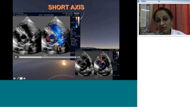 CXR, Echo, Angio Quiz by Dr Vijaylakshmi смотреть онлайн