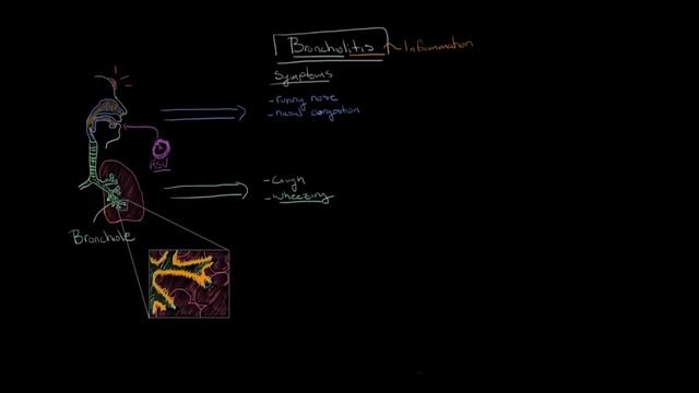What is bronchiolitis? | Respiratory system diseases | NCLEX-RN | Khan Academy смотреть онлайн