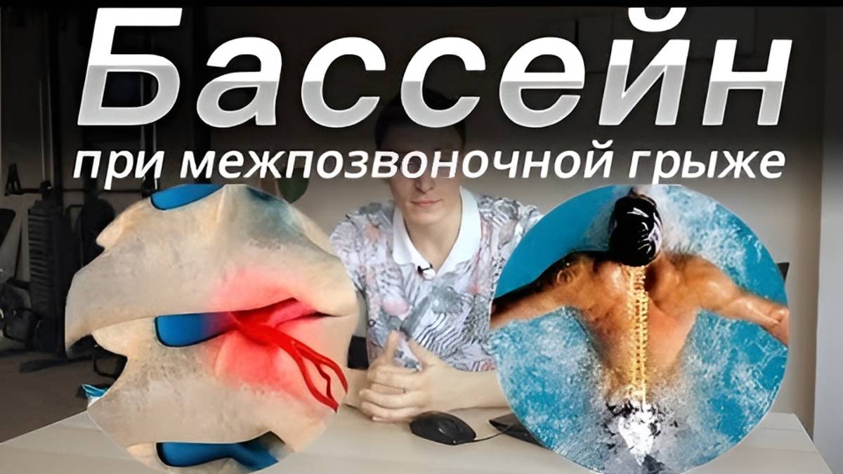 Плавание и грыжа: когда можно ходить в бассейн? смотреть онлайн