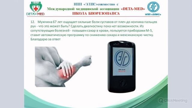 Боли в суставах рук 2020.05.20 смотреть онлайн