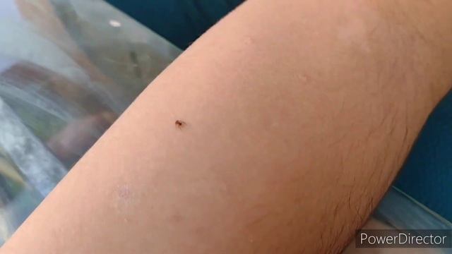 STUNG BY A RED IMPORTED FIRE ANT (Solenopsis Invicta) смотреть онлайн