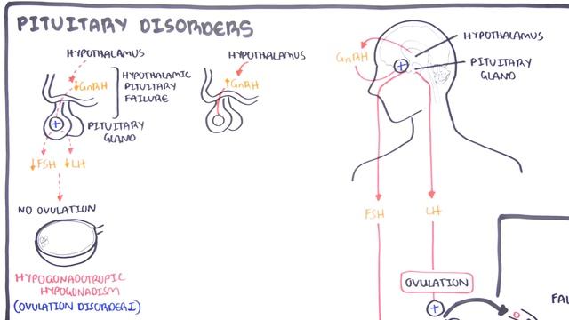 Gynaecology - Infertility in Women (causes and pathophysiology) смотреть онлайн