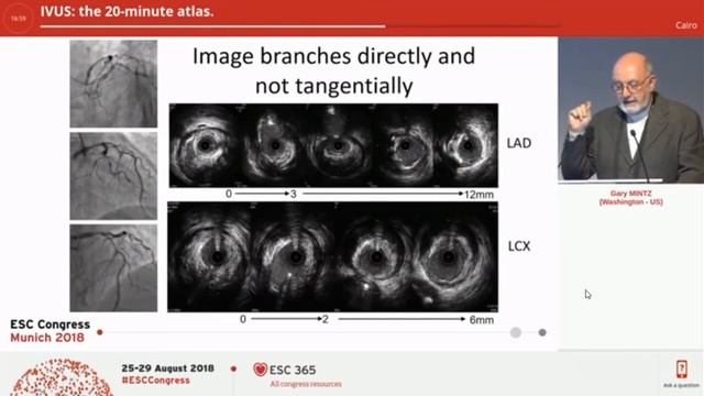 Ivus Interpretation