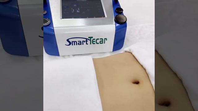 Tecar therapy machine - SmartTecar PRO | MTS смотреть онлайн