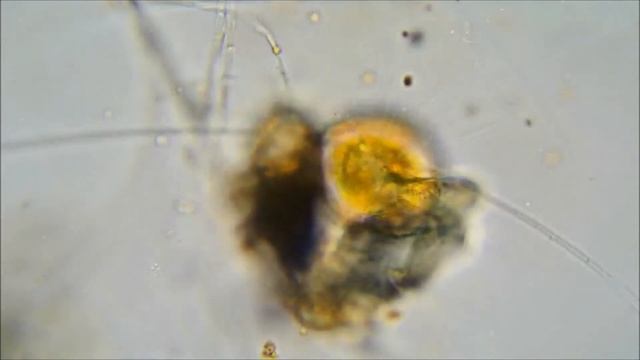 Амёба Нуклеария (Nuclearia) пытается съесть сине-зеленую водоросль Осциллаториа (Oscillatoria)