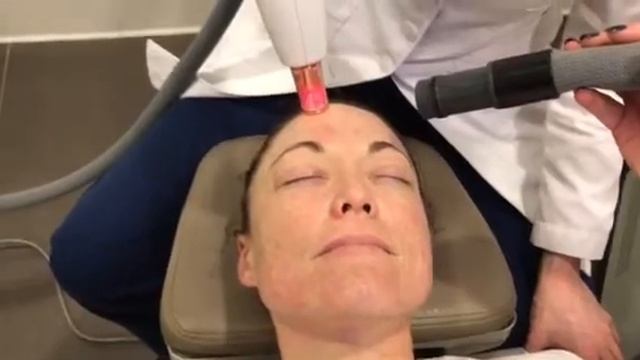Infrared Laser Peel with ResurFX смотреть онлайн