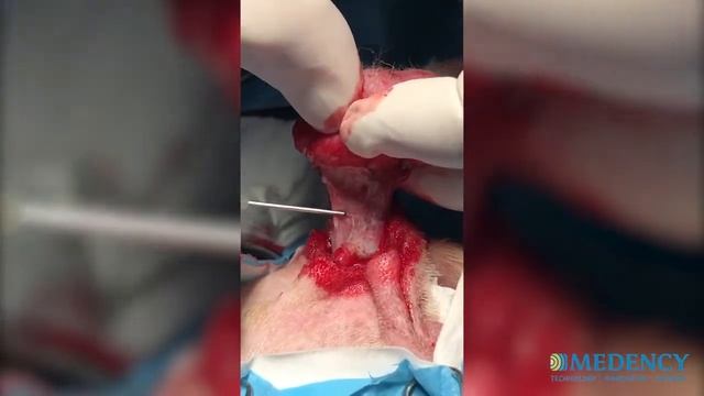 Veteo diode laser VET surgery - Skin auricle nodule removal_dog смотреть онлайн