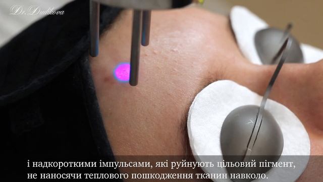 ENLIGHTEN — PICO+NANO СЕКУНДНИЙ ЛАЗЕР смотреть онлайн
