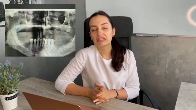 Обговорення клінічного випадку на конкретному прикладі панорамного знімку 🦷 смотреть онлайн