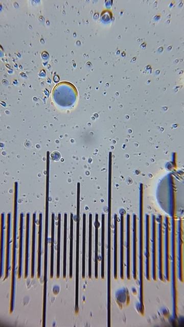 Bacteria and particles in a drop of water taken from used dish sponge, using Diple Grey + Smartphon смотреть онлайн