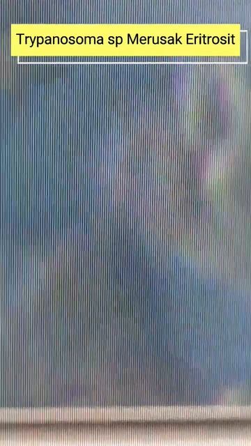 Zoom 1000x Trypanosoma 2 #shorts , #biology , #darah , #parasite , #protozoa , #mikroskop