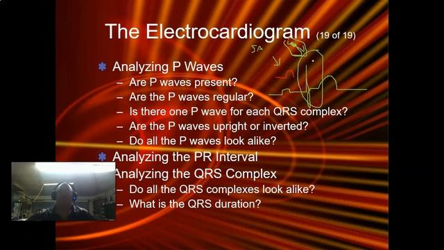 How to Analyze an ECG the basics смотреть онлайн