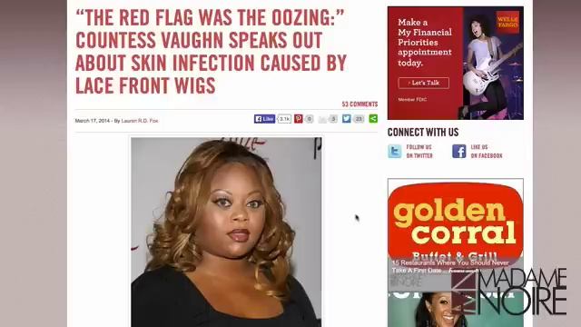 Countess Vaughn Speaks Out About Skin Infection Caused By Wigs | MadameNoire смотреть онлайн
