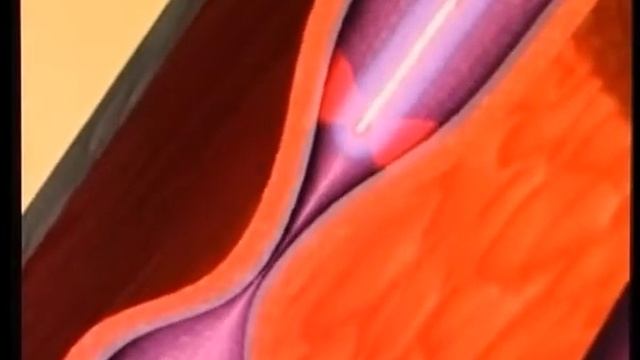 Лечение варикоза в клинике С.Г. Крыгина смотреть онлайн