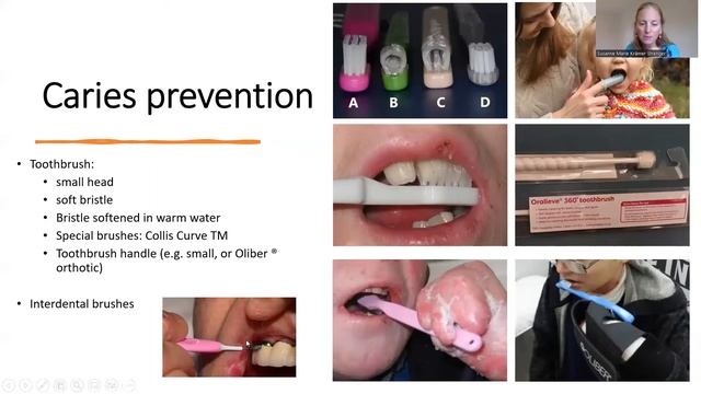 Oral care in EB смотреть онлайн