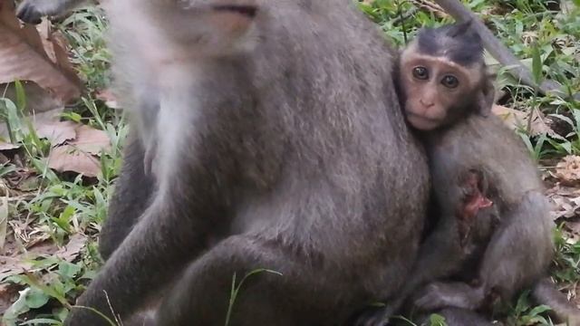 Pity baby Nanda cry cos painful of wound | It's great mom take care her Baby Nanda full | смотреть онлайн
