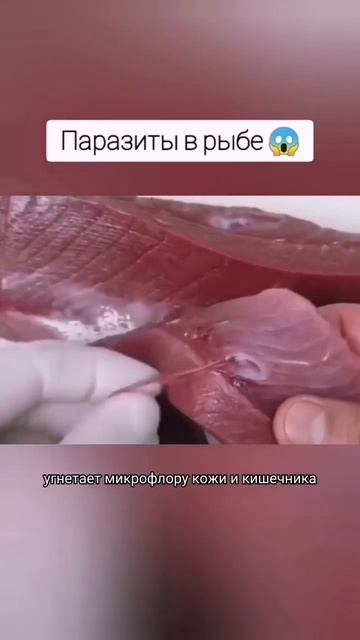 #паразиты #гельминты #глисты #антипаразитарка #тригельм #здоровье #сибирскоездоровье смотреть онлайн